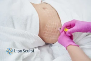 Are The Results From Aqualyx Permanent? 1 Do you want to know how long Aqualyx Frimley results last?