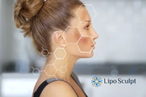 Are you looking at age spots Frimley removal? Contact Lipo Sculpt today!