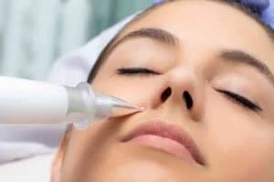 Best Actinic Keratoses Removal 3 Actinic keratoses Frimley solutions - book in today!