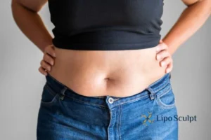 Bidding Farewell to Muffin Tops with Aqualyx Fat Injections 2 Do you wish you could reduce your muffin top Frimley With Aqualy fat dissolving injections you can!