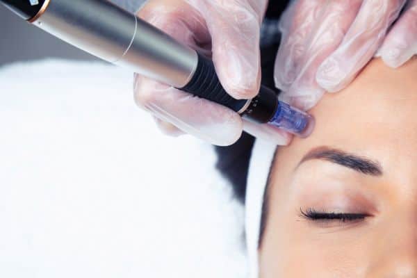 Explaining Total Skin Tightening Treatment and What to Expect 2 What Skin Concerns Can Total Skin Tightening Treatment Help With Frimley?